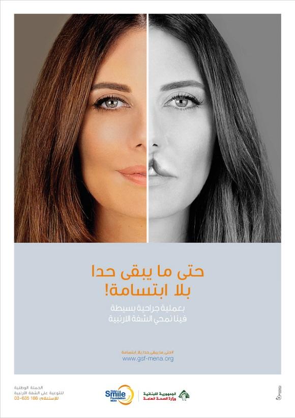 الحملة الوطنية للتوعية عن العيوب الخلقية "الشفة الأرنبية" 2016