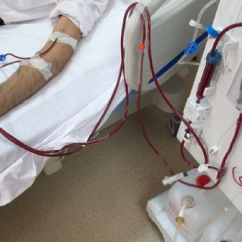 الصحة تعلن عن تعديل تعرفة جلسة علاج غسيل الكلى