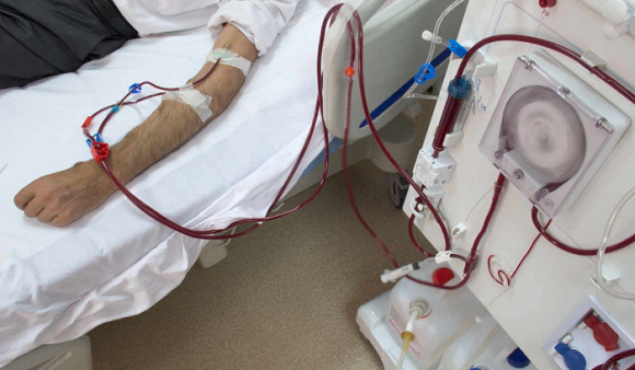 الصحة تعلن عن تعديل تعرفة جلسة علاج غسيل الكلى