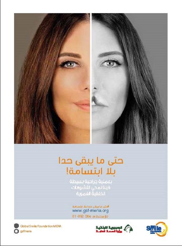 الحملة الوطنية للتوعية على التشوهات الخلقية الفموية في لبنان 2018